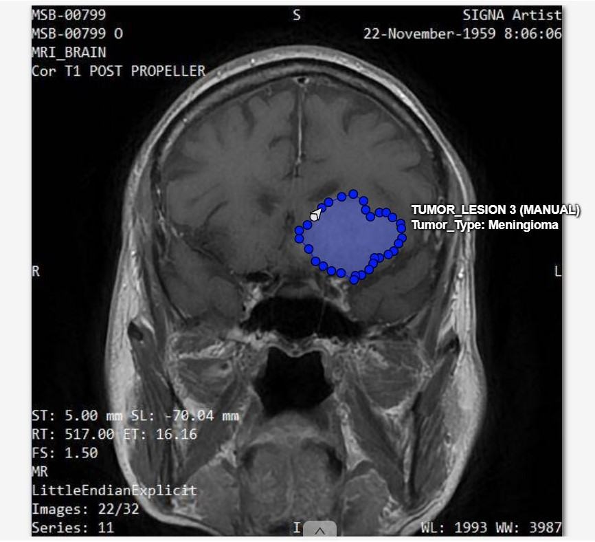 Medical Imaging Segmentation
